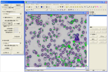 感染血球を自動認識可能