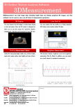 3DMeasurement