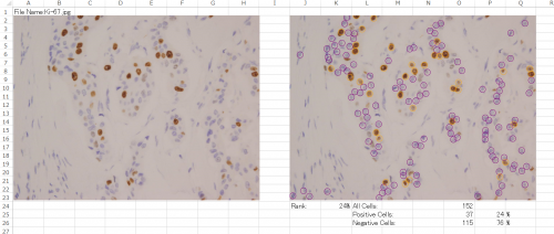 Patholoscope-excel.png