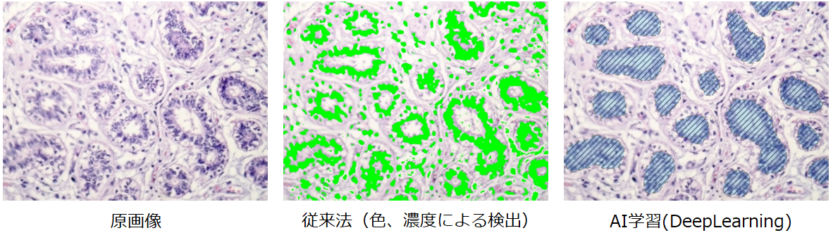 AI画像解析と従来法の比較