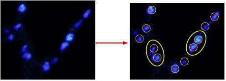 PatholoCount_sample002.jpg