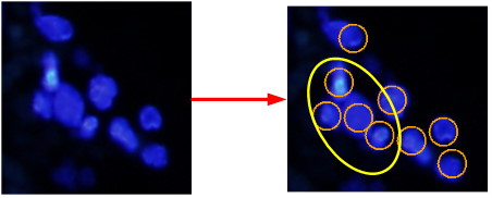 PatholoCount_sample003.jpg