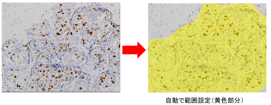 高速細胞カウント_情報3.png