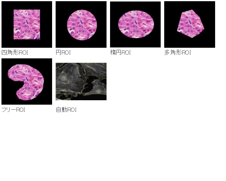 ROI設定